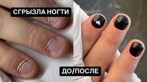 Обгрызенные ногти / Проблемная кутикула