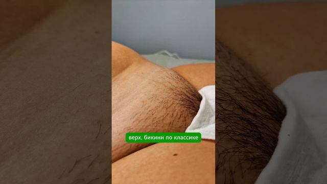 Запись на электроэпиляцию через wa 79688033388 #электроэпиляциямосква #электроэпиляция