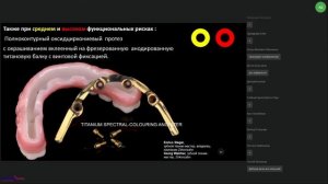 49. Стоматологическая реабилитация с помощью ангулированных имплантатов