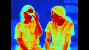 Slight Fever, seen through Thermal Camera (Opgal Therm-App)
