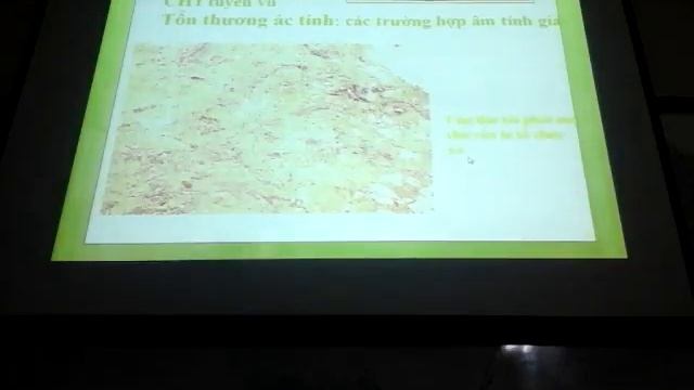 Cộng hưởng từ tuyến vú смотреть онлайн