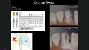 _Методики препарирования зубов под цельнокерамические реставрации._(18.06.2019)