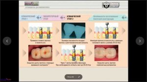 06. 2019 02 05 Сидоров Владимир Иванович Протезирование на имплантах Ч1