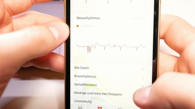 Apple Watch 4 EKG in DEUTSCHLAND! WatchOS 5.2 Update смотреть онлайн