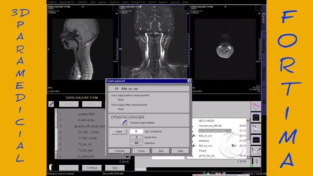CONTRAST ANGIOGRAPHY MRI NECK смотреть онлайн