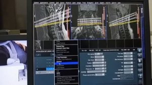 The MRI Cervical Spine //Positioning//Procedure//Filming