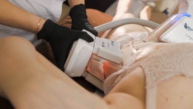 Cryolipolysis смотреть онлайн