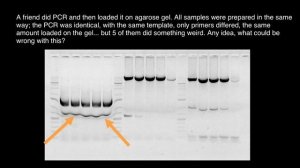 Gel Electrophoresis troubleshooting