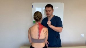 Боль в шее и между лопаток | Трапециевидная мышца