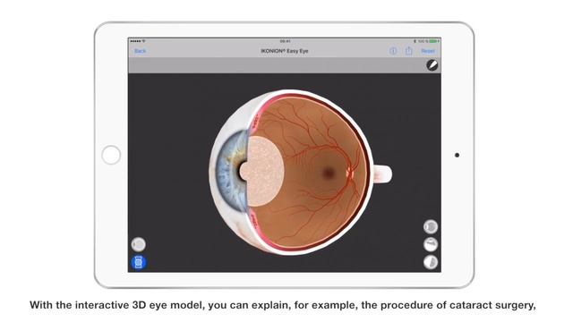 Easy Eye - Best Vision Simulator - 3D Eye Model - 3D Animations - Premium Lenses - Patient Educatio смотреть онлайн