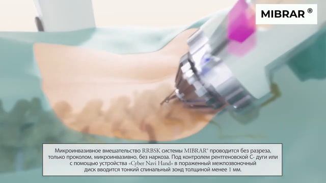 Методика лечения заболеваний позвоночника без операции из Германии #MIBRAR, #ЛечениеПозвоночника