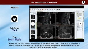 MicroDicom | Top 15 Alternatives of MicroDicom