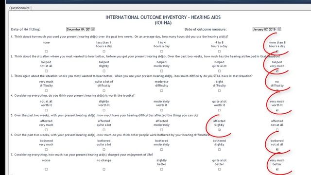Costco Hearing Aids | The GOOD, The BAD, & The UGLY смотреть онлайн