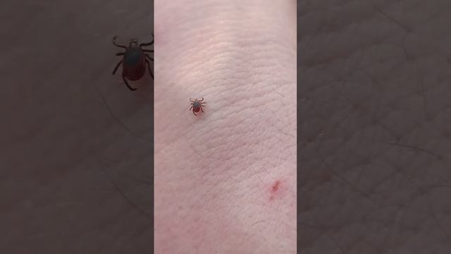 Клещ ищет кровь #shorts смотреть онлайн