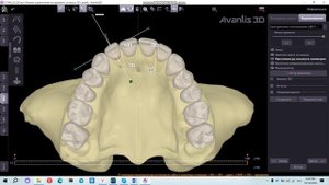 Ручное выравнивание