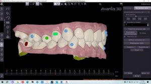 Расстановка аттачментов