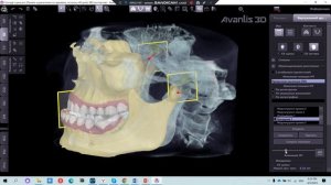 Аксиография