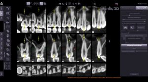 Просмотр КТ