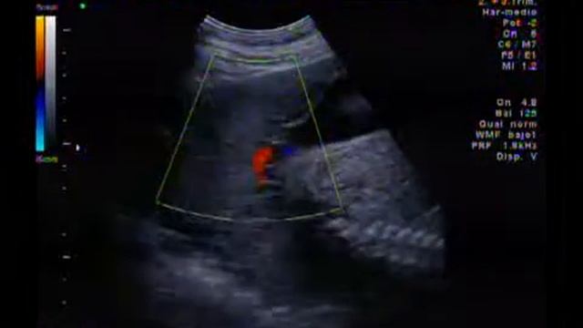 VTS 01 2   iPhone   MPEG4 Video11 смотреть онлайн