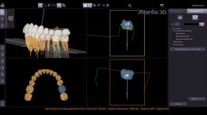 Симуляция корней без КТ