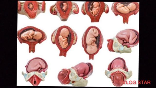 pregnancy ultrasound me placenta grade 01234 ka kya matlb hota he