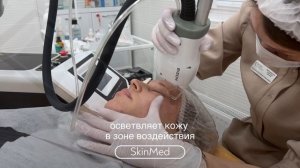 Что такое безоперационная блефаропластика?