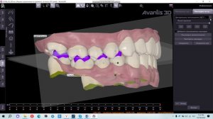 Расстановка накладок