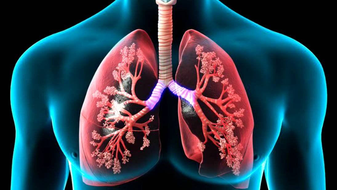 22.10.2024 Индивидуальная сессия Бронхит. Новые программы