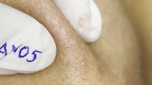 Most Satisfying and Relaxation with An Spa Video #04