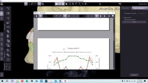 Анализ пародонта