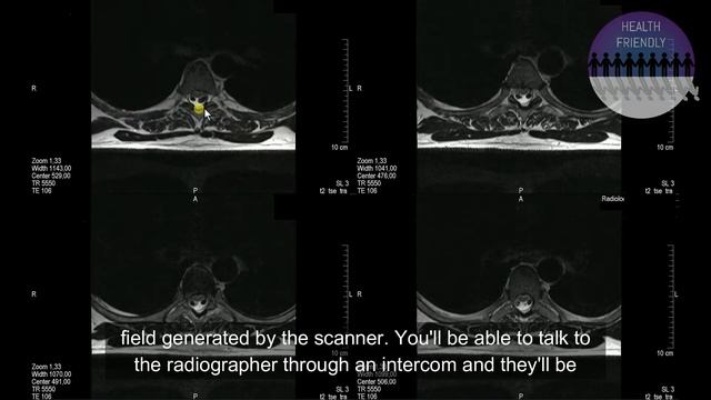 MRI Scan