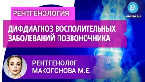 Рентгенолог Макогонова М.Е.: Диф. диагностика воспалительных заболеваний позвоночника