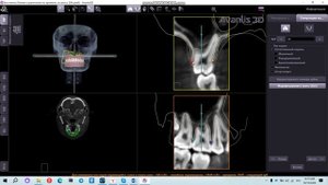 Симуляция корней по КТ