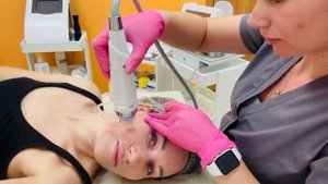 Микроигольчатый рф лифтинг