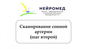 Сканирование сонной артерии Шаг 2 (Переход в продольное сканирование из поперечного)