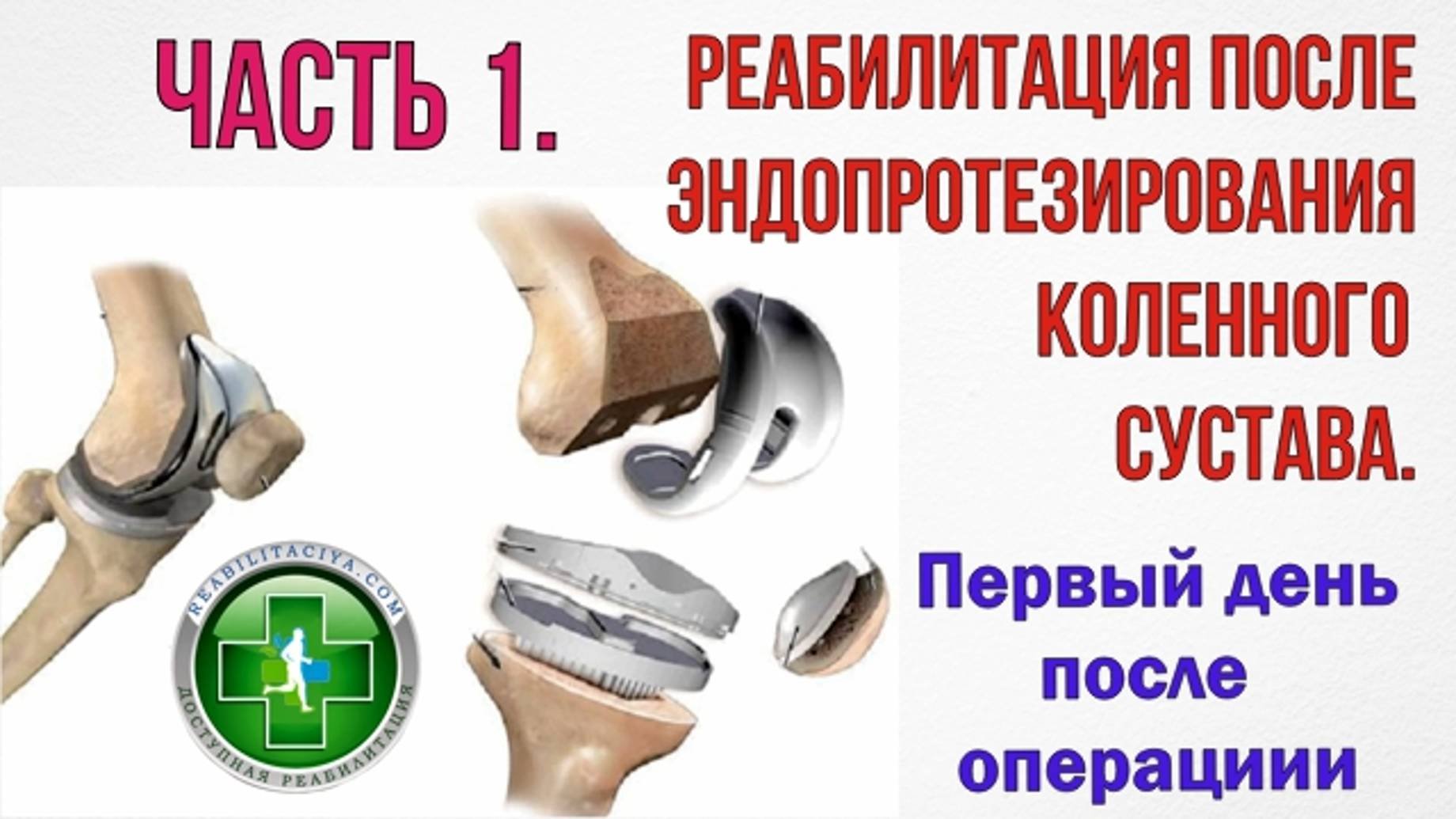 Эндопротезирование тазобедренного отзывы пациентов после операции. Эндопротезирование тазобедренного отзывы пациентов после операции