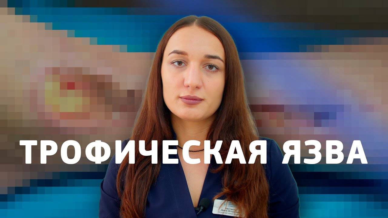 ТРОФИЧЕСКАЯ ЯЗВА - критическое осложнение варикозной болезни