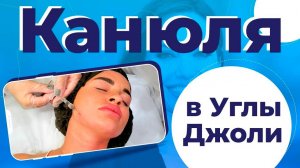 Канюля в Углы Джоли