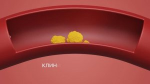 Снижаем холестерин с Мультифлора Эвалар Холестерол