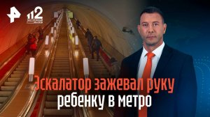 Эскалатор зажевал руку четырехлетнему мальчику в метро