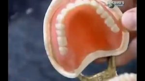 Как это работает: Искусственные зубы