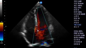 Cardiac Imaging zoncare-Q6 02