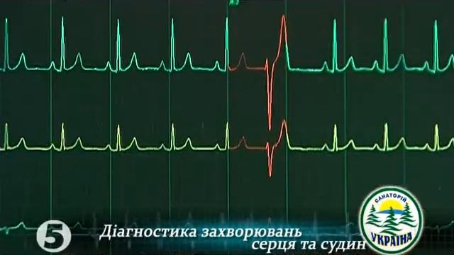 инфаркт миокарда реабилитация смотреть онлайн