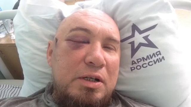 11.10.2022г рассказал про ранение. Воложанин Александр. Якудза
Что с глазом? Можно восстановить? так