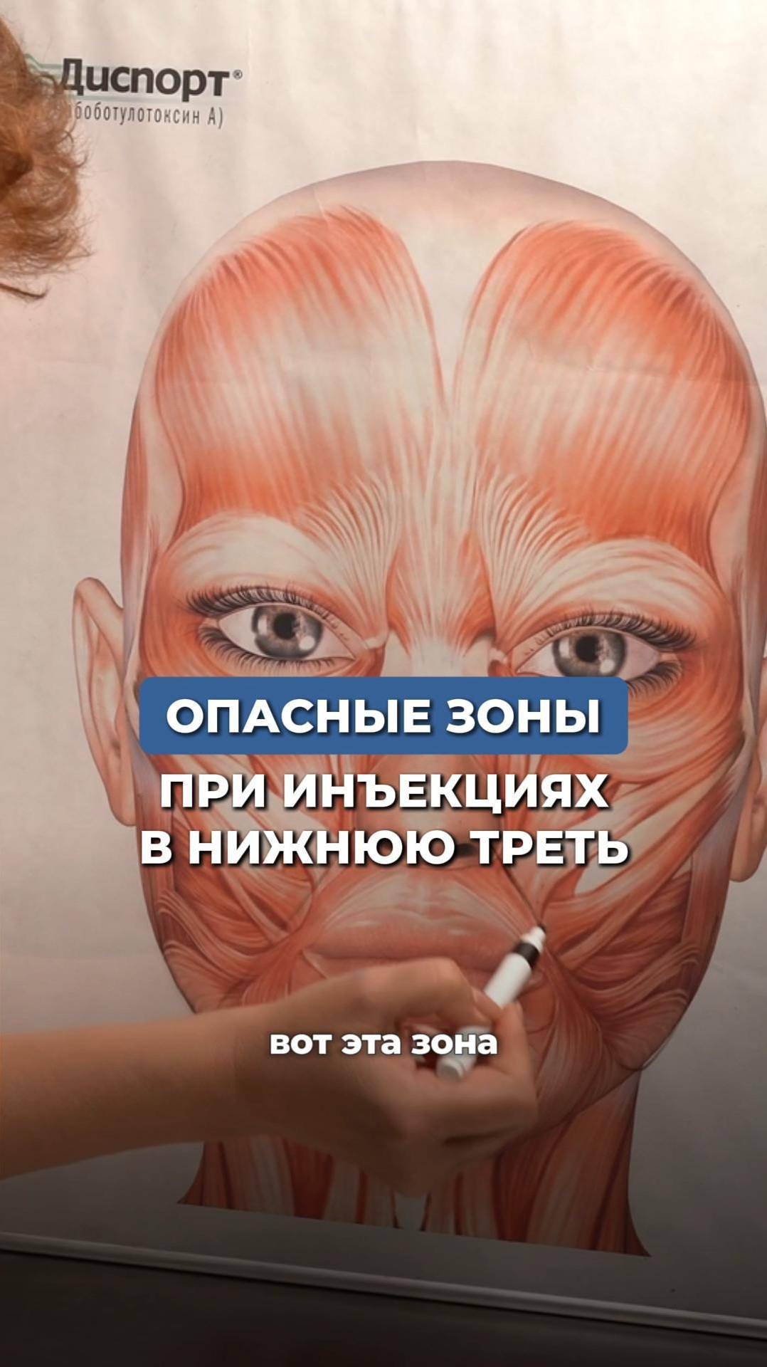 ОПАСНЫЕ ЗОНЫ ПРИ ИНЪЕКЦИЯХ  #инъекционнаякосметология #косметолог