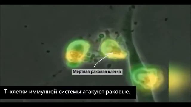 Как работает наш иммунитет