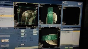 Shoulder MRI scan protocol, positioning and planning on GE 1.5 Tesla | Live Demo in English.