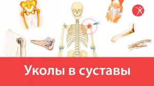 Уколы в суставы