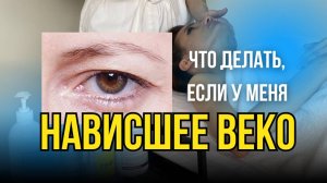 Нависшее веко: причины появления и способы устранения.