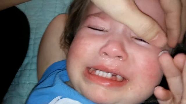 Eden Lens Insertion - LEFT EYE